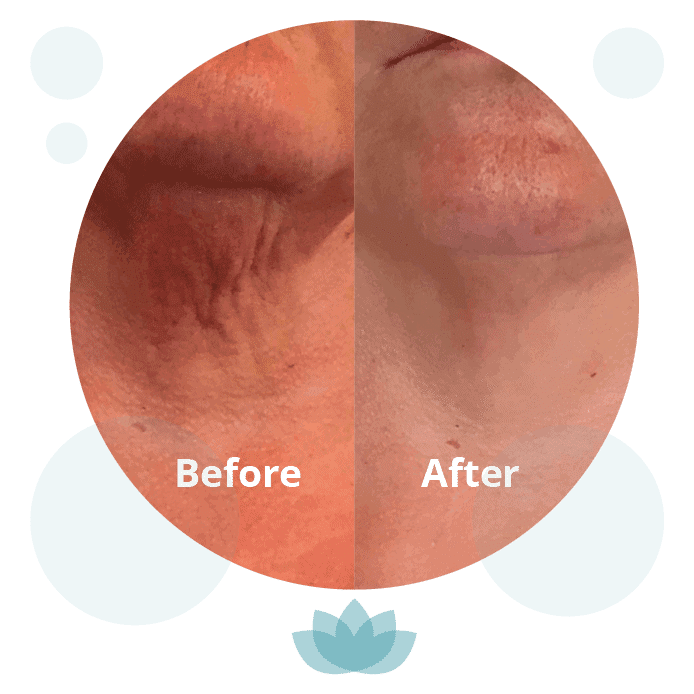 RejuvaMed Health & Wellness | How Can We Help? 3D Cavitation & RadioFrequency Circle