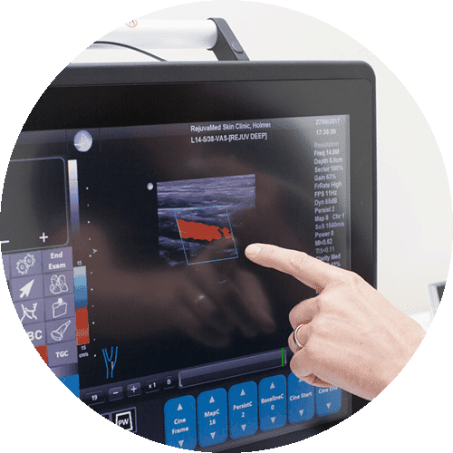 Hand pointing at thermal imaging display screen showing heat signature