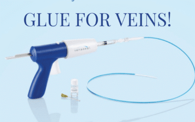 VenaSeal – It’s glue for veins!