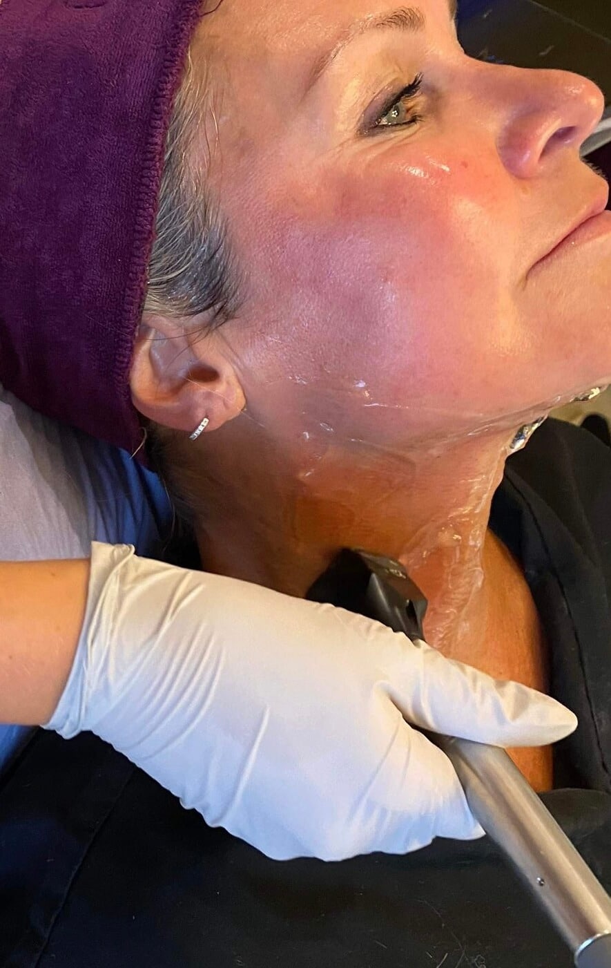 RejuvaMed Health & Wellness | Forma RF