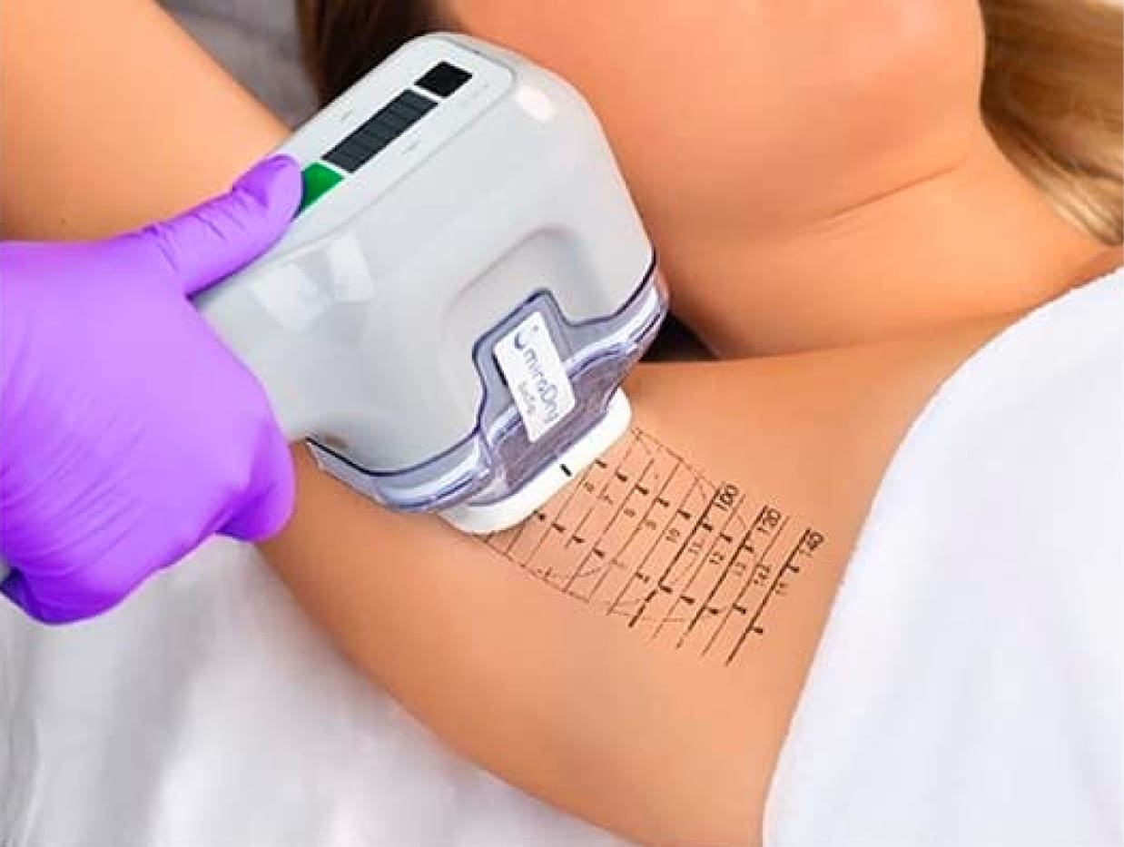 RejuvaMed Health & Wellness | MiraDry Sweat Treatment Spectrophotometer skin tone measurement device on arm
