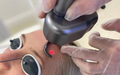 RejuvaMed Health & Wellness | CO2 Laser Skin Resurfacing - Everything You Need to Know CO2 Laser Skin Resurfacing – Everything You Need to Know