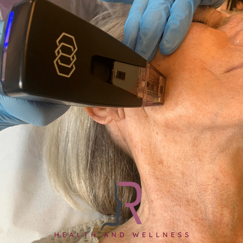Person wearing blue gloves using handheld laser therapy device