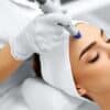 xr:d:DAFMzK1A3Z0:47,j:38484796488,t:22101919 Professional dermatologist performing laser skin treatment on patient