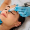 undefined Professional laser skin treatment procedure on patient's face