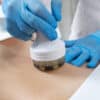 Hardware cosmetology. Young woman getting beauty treatment in a spa salon Healthcare professional applying ultrasound gel with probe on skin