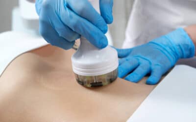 RejuvaMed Health & Wellness | Is 3D Lipo Fat Freeze Effective for Stubborn Fat Pockets? Is 3D Lipo Fat Freeze Effective for Stubborn Fat Pockets?