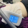 IMG_8726 Ultrasound probe on skin with medical device display