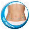 3D Fat Freezing Abdomen with blue dotted surgical lines for fat removal