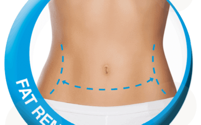 RejuvaMed Health & Wellness | 3D Fat Freezing in Lancashire: Does It Really Work for Stubborn Fat? 3D Fat Freezing in Lancashire: Does It Really Work for Stubborn Fat?